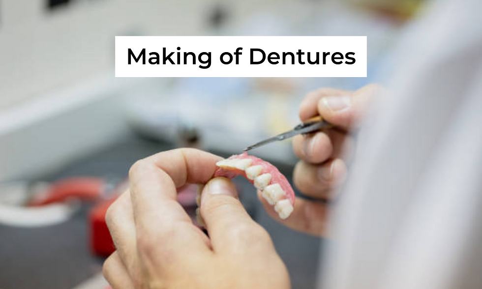 Partial Denture in Whitefield