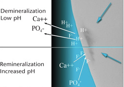 Fluoride Helps In Remineralising The Tooth Structures