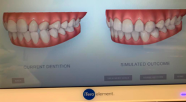 Step 4 - Extra oral Orthodontic facial assessment