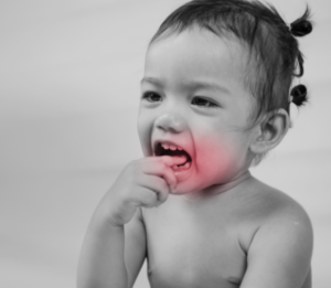 Tooth Mousse Teeth Sensitivity