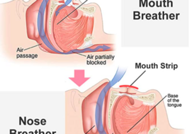 Mouth Breathing Causes and Long-Term Impacts