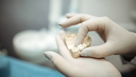 How to Choose the Best Root Canal Treatment Cap for Your Tooth