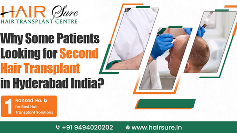 Why Are Some Patients Looking for a Second Hair Transplant in Hyderabad, India?