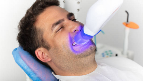 Tooth Discolouration: Causes, Prevention and Treatments