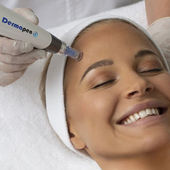 Dermapen: terapia anti imperfecciones