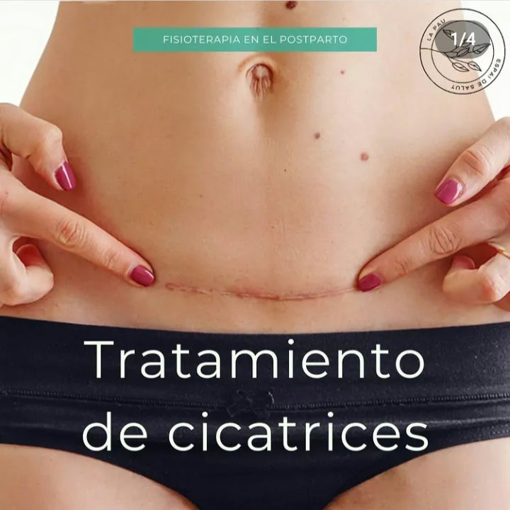 Tratamiento de cicatricea