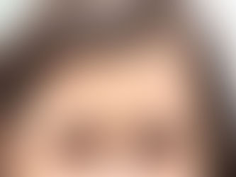 resistance to botulinum