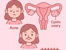 รู้ทันและรับมือ PCOS ด้วยอาหาร เปลี่ยนวิถีชีวิตสู่สุขภาพดี