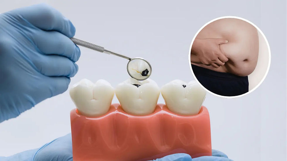 Estudio revela que la pérdida de dientes influye en el aumento de peso