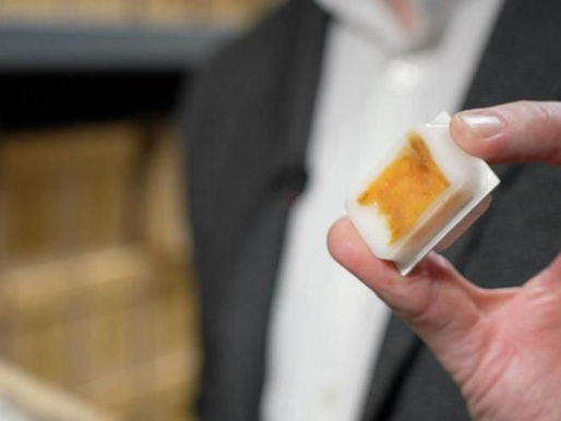  Científicos analizan muestras de cáncer de intestino almacenadas por décadas para entender por qué la enfermedad crece entre jóvenes.