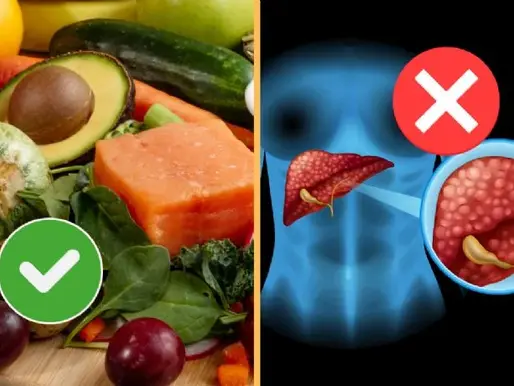 7 alimentos que pueden perjudicar tu hígado, según un especialista.