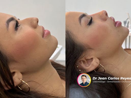Cómo Instagram y TikTok están cambiando la percepción de la belleza y la autoestima, según el Dr. Jean Carlos Reyes Guerrero