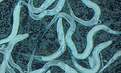 2026 - PARASITES - INTESTINAL WORMS.png