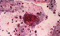 2026 - PARASITES - HURPSICUM VIRA.png