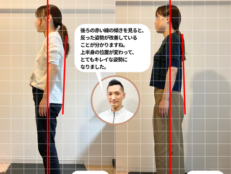 猫背と反り腰が改善して姿勢がキレイに!