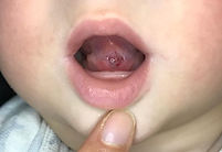 Tongue after division