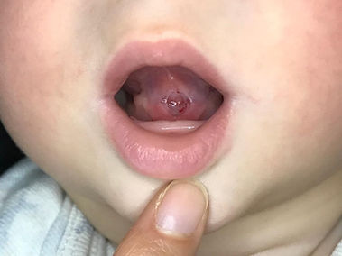 Tongue after division.jpeg