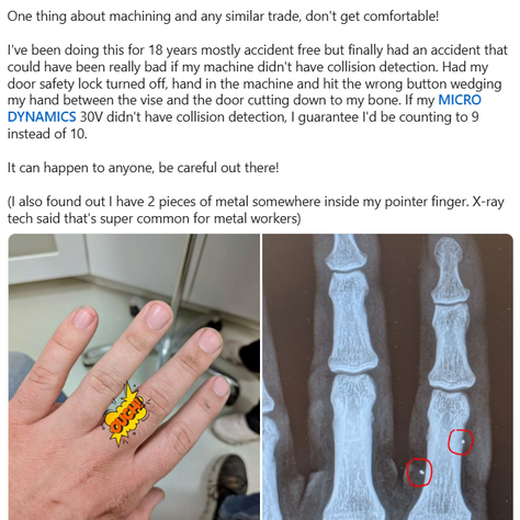 Photo of a hand compared to an xray, proving MicroDynamics collision detection works well