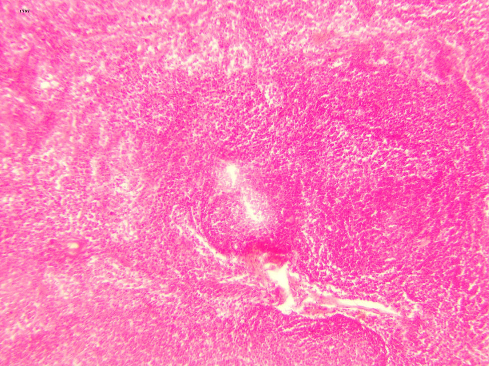 Parathyroid