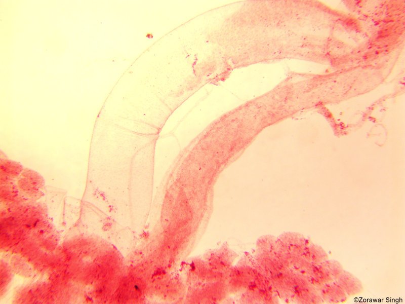 Salivary Glands of Cokroach Receptacle Duct 5X (Copy)