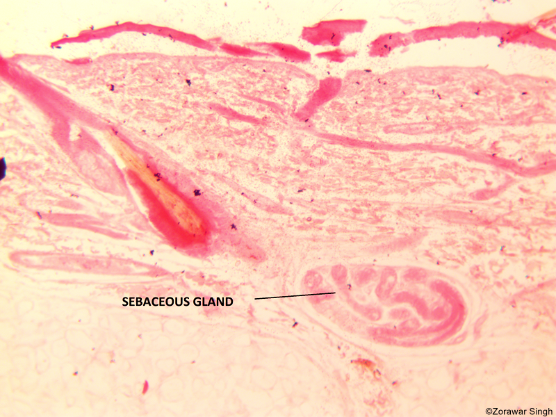 VS Skin of Mammal Sebaceous Gland 10X (Copy)