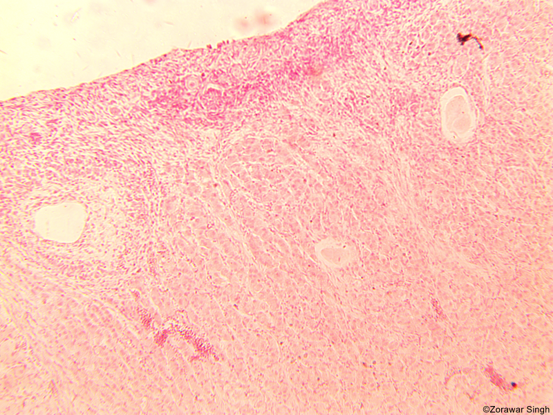 TS Ovary of Human 10X (Copy)