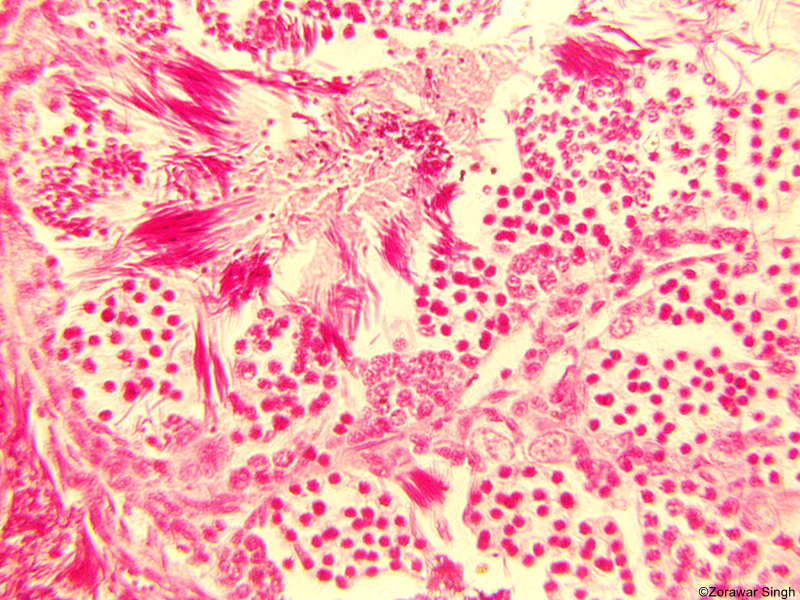 TS Testis Frog 40X (Copy)