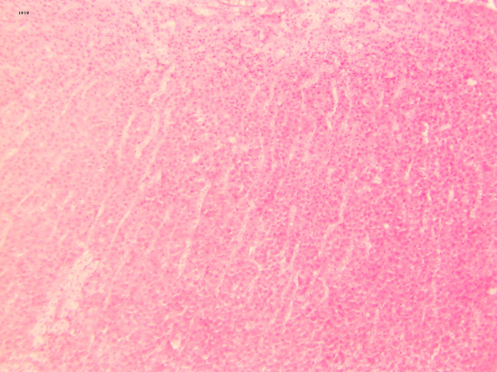 Adrenal