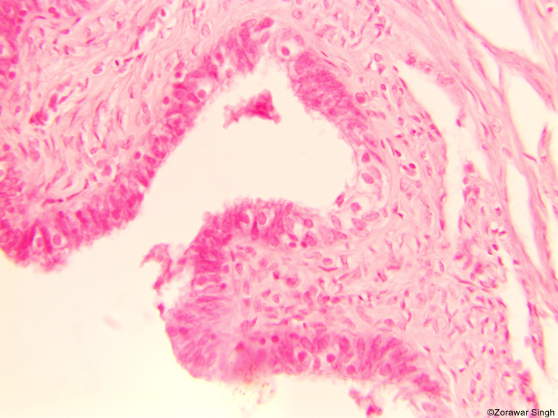 TS Fallopian Tube 45X (Copy)