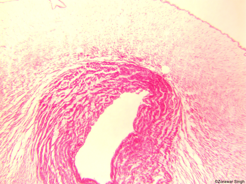 TS Umblical Chord 5X (Copy)