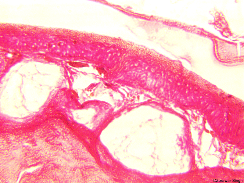 TS Skin Frog 45X2 (Copy)