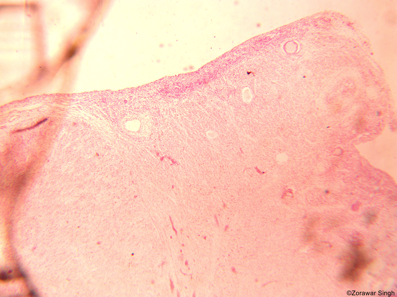 TS Ovary of Human 5X (Copy)