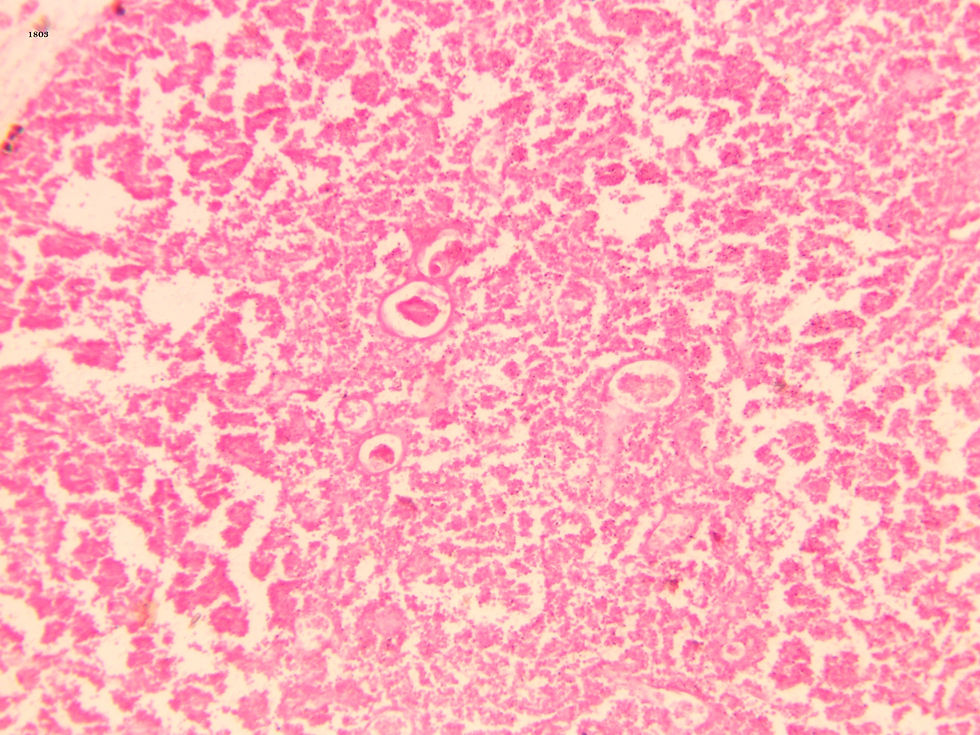 Thymus