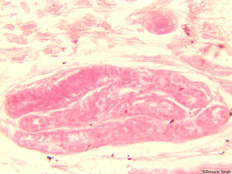 VS Skin of Mammal Sebaceous Gland 45X (Copy)