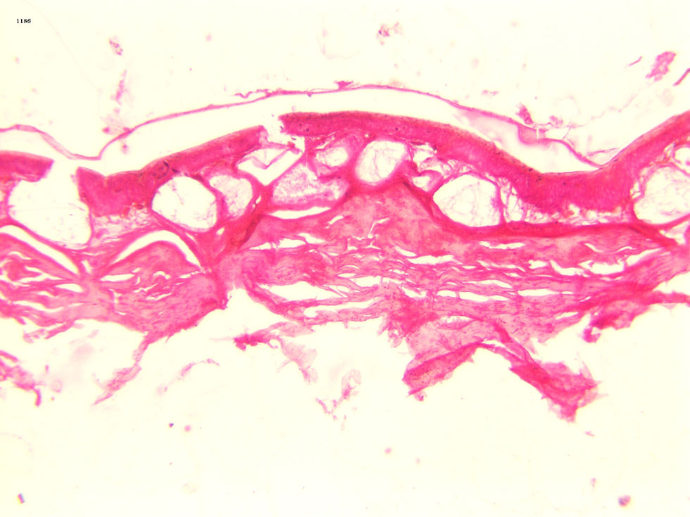 Skin FROG