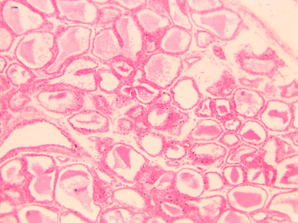 Thyroid