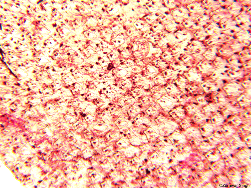 Skin of Dogfish 5X (Copy)