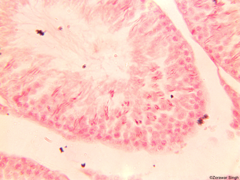 TS Testis of Human 40X (Copy)