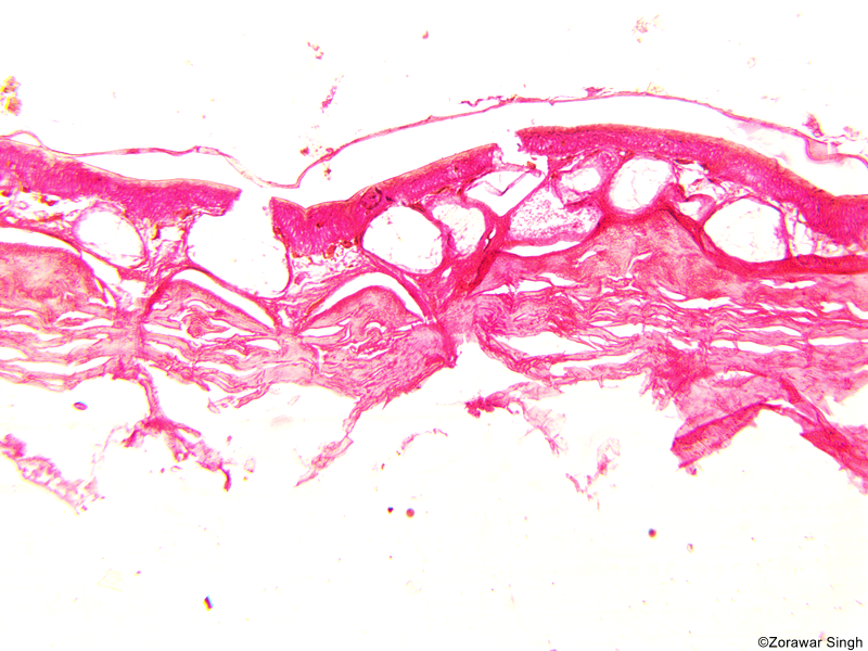 TS Skin Frog 10X (Copy)