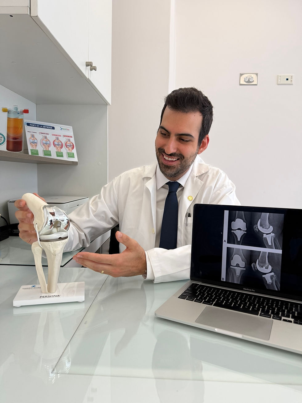 ¿Cuándo es el momento de considerar un reemplazo total de rodilla?