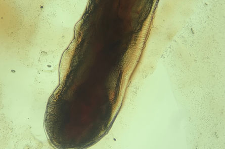 Syngamus trachea em Sabiá-barranco