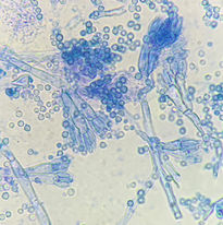 Penicillium