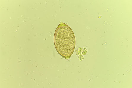 Ovos de Trichuris