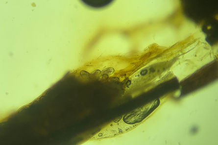 Syngamus trachea em Sabiá-barranco