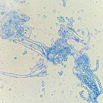 Penicillium