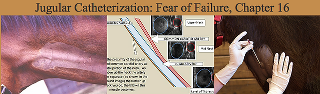 Jugular Catherization