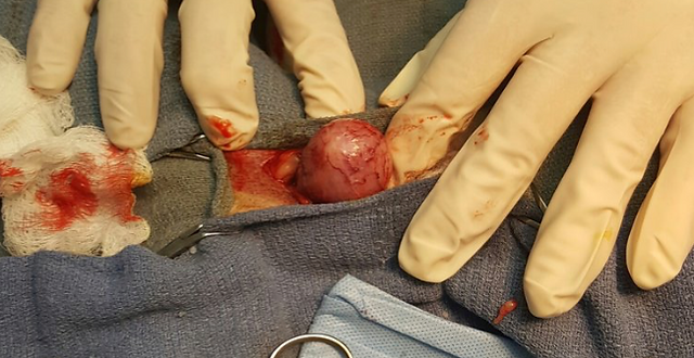 Bladder 5