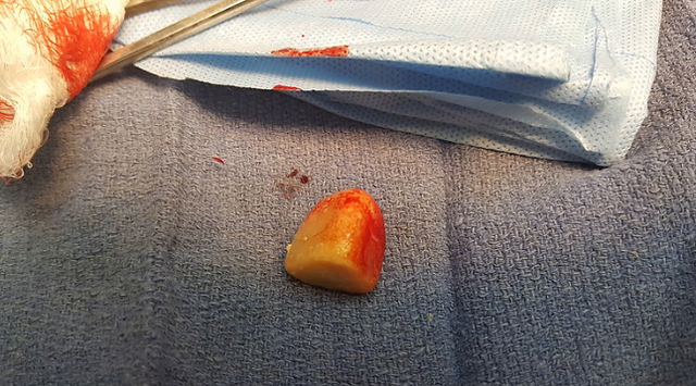 Bladder 7
