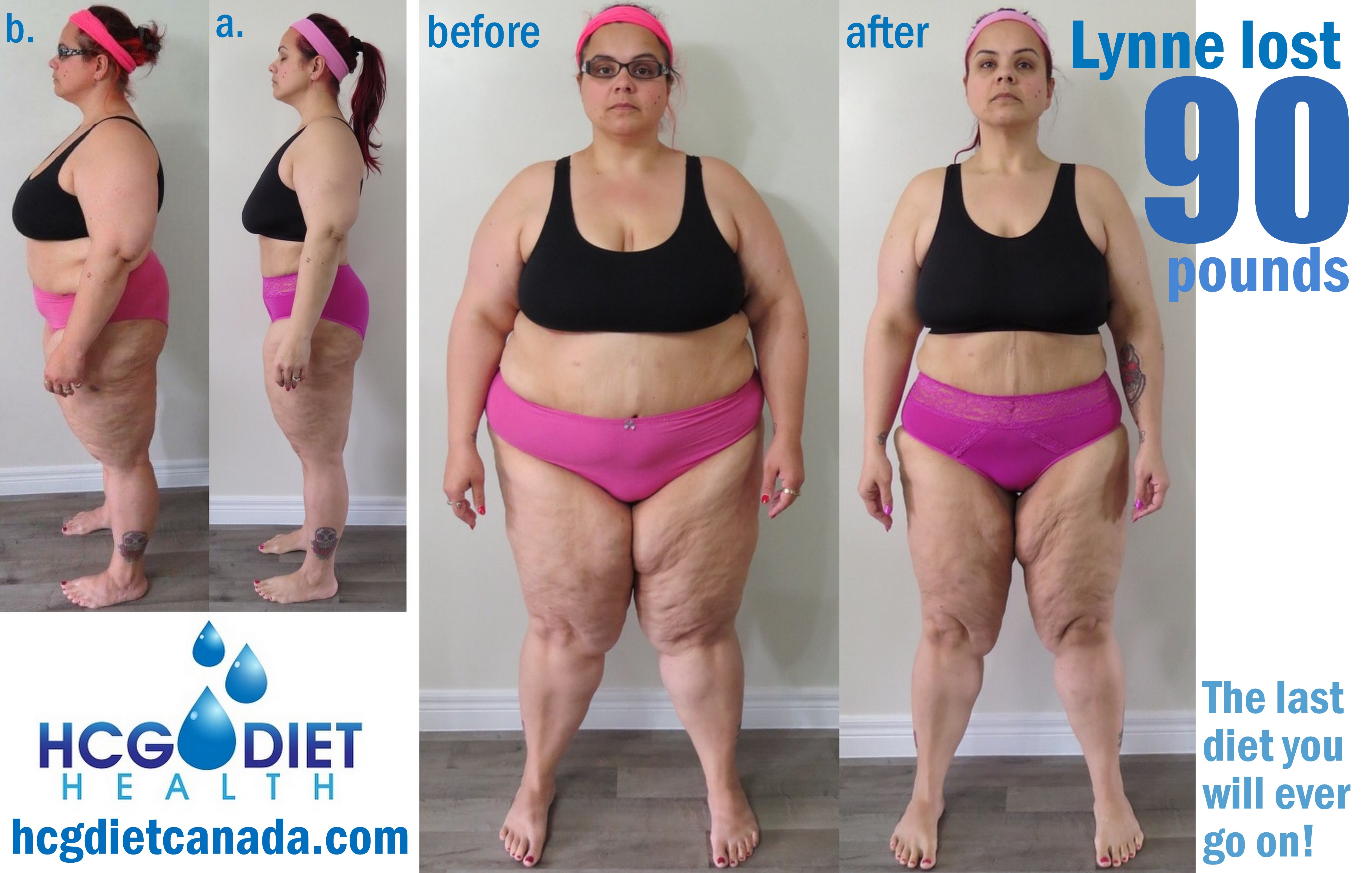 Lynne hcg diet.jpg