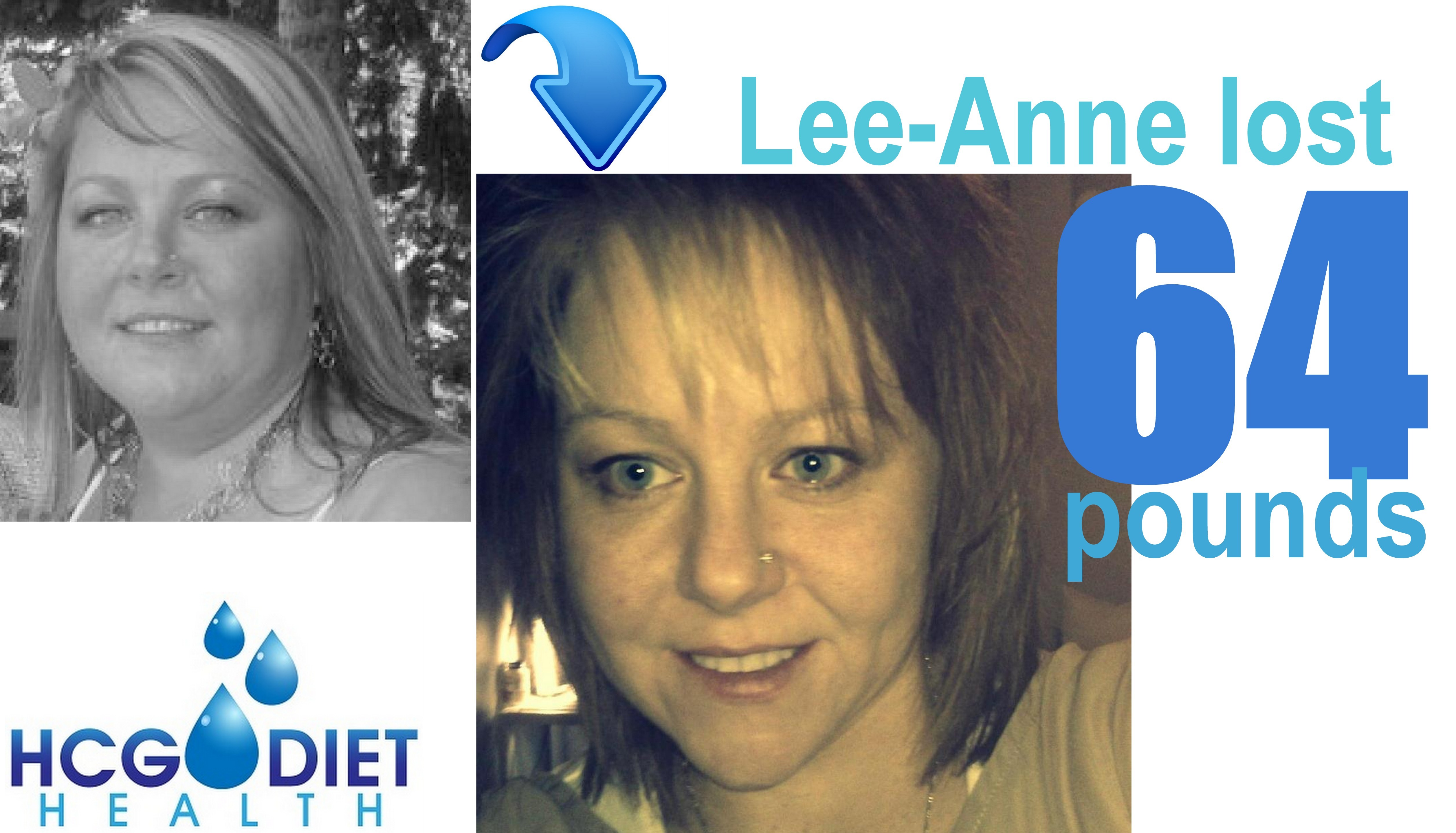 real hcg diet Canada 11